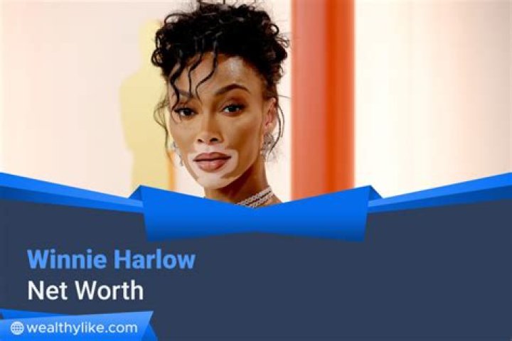 Winnie Harlow Net Worth: Details About Modeling, Income, Bf, Cars, Career - SarkariResult